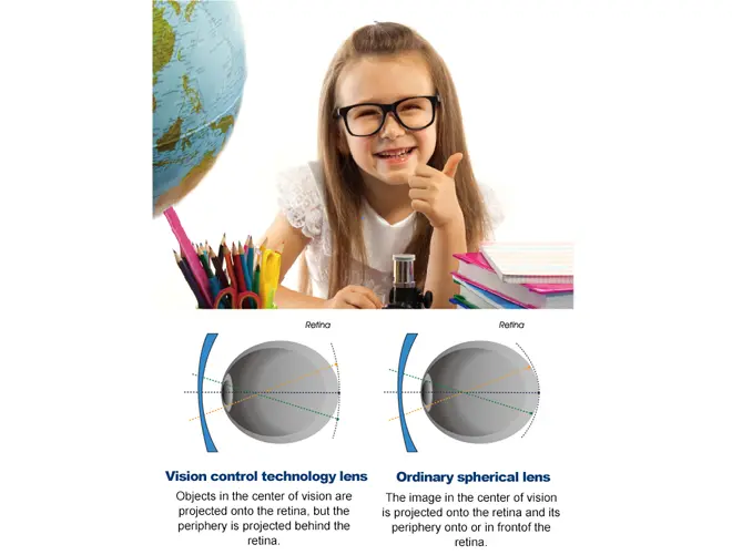 Specification of Myovision Peripheral Defocus Kids Myopia Control Single Vision Lens